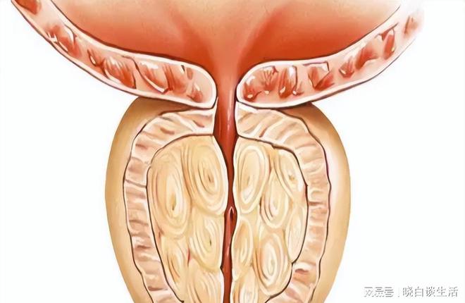 前列腺炎與性功能改善，探索康復(fù)之路，前列腺炎與性功能改善，探索康復(fù)之路的旅程